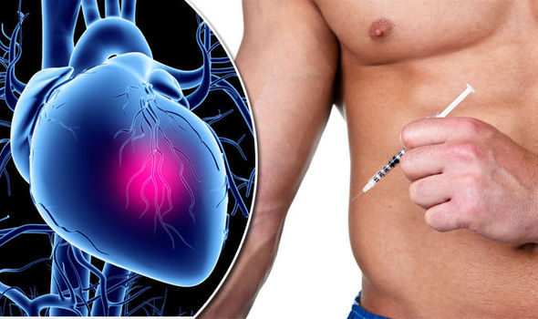 Steroids-musculation-effets